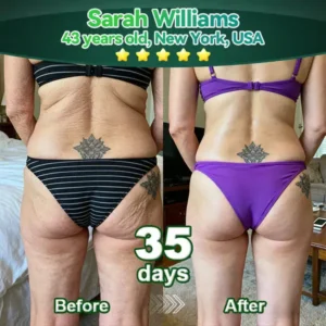 Alisanda® 𝖢𝗁𝗅𝗈𝗋𝗈𝗉𝗁𝗒𝗅𝗅 & 𝑆𝑡𝑒𝑚 𝐶𝑒𝑙𝑙 𝖻𝗈𝖽𝗒 𝗋𝖾𝗇𝖾𝗐𝖺𝗅 𝗌𝖾𝗋𝗎𝗆（𝐿𝑖𝑓𝑡 & 𝐹𝑖𝑟𝑚 𝑆𝑎𝑔𝑔𝑖𝑛𝑔 𝑆𝑘𝑖𝑛 & 𝑅𝑒𝑑𝑢𝑐𝑒 𝑊𝑟𝑖𝑛𝑘𝑙𝑒 𝐹𝑜𝑟𝑚𝑎𝑡𝑖𝑜𝑛