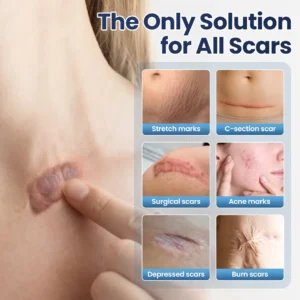 🔥Last Day Discount🔥 Alisanda® Texture Repair Gel