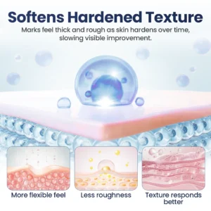 🔥Last Day Discount🔥 Alisanda® Texture Repair Gel