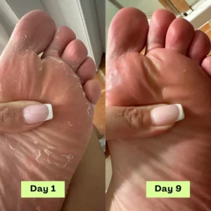 Alisanda™ - Antifungal Tea Tree Soap Bar