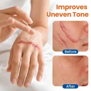 Alisanda® DermalRebuild Daily Renewal Gel