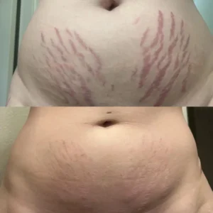 Alisanda® DermalRebuild Daily Renewal Gel