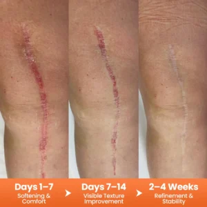 Alisanda® DermalRebuild Daily Renewal Gel