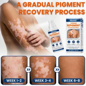 ⚡Alisanda® Piperine Re Pigment Activator Spray to Reactivate Dormant Pigment Cells & Restore Natural Skin Color