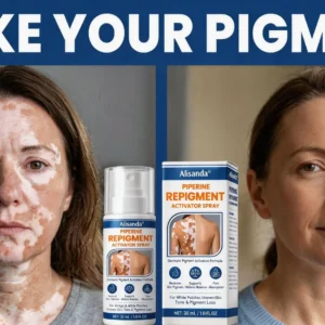 ⚡Alisanda® Piperine Re Pigment Activator Spray to Reactivate Dormant Pigment Cells & Restore Natural Skin Color