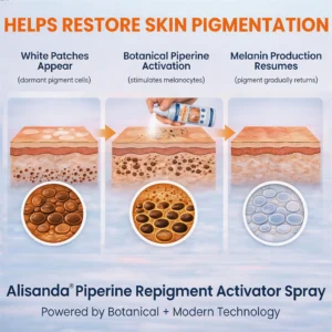 ⚡Alisanda® Piperine Re Pigment Activator Spray to Reactivate Dormant Pigment Cells & Restore Natural Skin Color