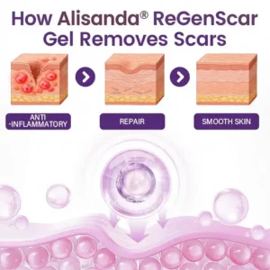 Alisanda® ReGenScar Rapid Recovery Scar Gel