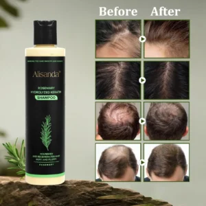 🔥LAST DAY 70% OFF - 🎅Alisanda® Organic Rosemary Hair Growth Shampoo