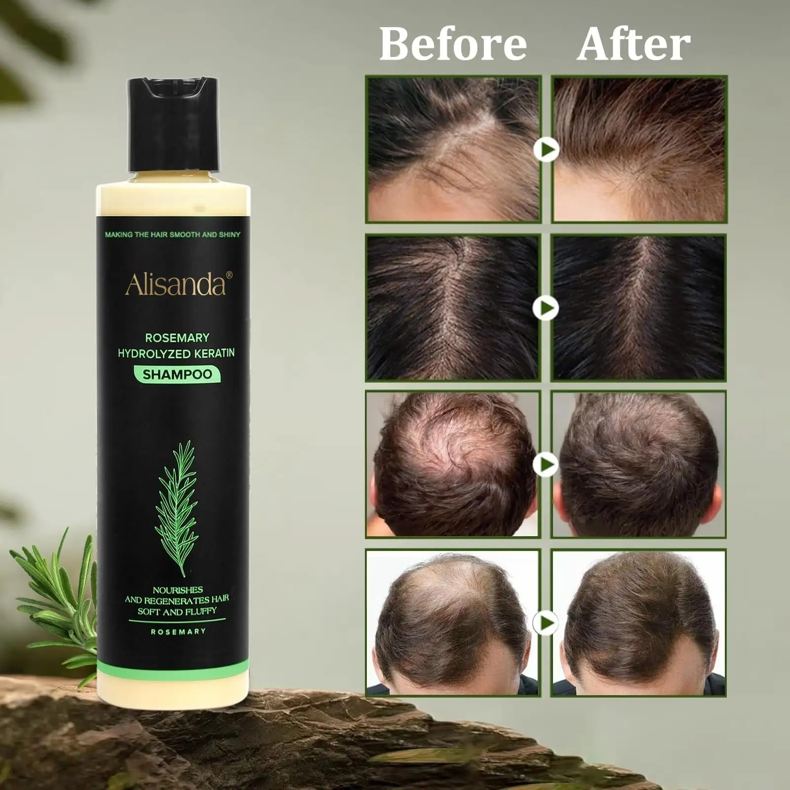 🔥LAST DAY 70% OFF - 🎅Alisanda® Organic Rosemary Hair Growth Shampoo