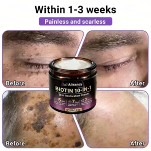 Made and Shipped from Canada ✨Alisanda® Biotin 10-in-1 Skin Restoration Cream