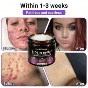 Made and Shipped from Canada ✨Alisanda® Biotin 10-in-1 Skin Restoration Cream
