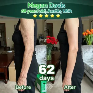 Alisanda® Chlorophyll & Stem Cell Body Rejuvenating Serum (Lifts and firms sagging skin, reduces the appearance of wrinkles)