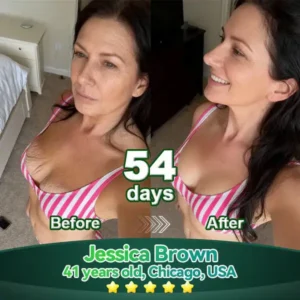 Alisanda® Chlorophyll & Stem Cell Body Rejuvenating Serum (Lifts and firms sagging skin, reduces the appearance of wrinkles)