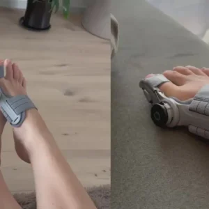 Alisanda® - Non-Surgical Relief for Bunion Pain