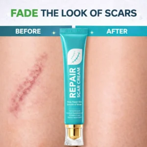 🌿Alisanda Scar Repair Cream|Treats Old and New Scars, Burns and More