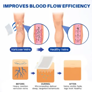 Alisanda® Vein Contour Micro-Patches: The 7-Day Transformation for Varicose Veins