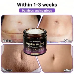 Watch Them Fall Off! ✨ Alisanda® 10-in-1 Skin Clear