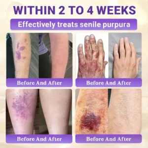 Watch Them Fall Off! ✨ Alisanda® 10-in-1 Skin Clear