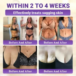 Watch Them Fall Off! ✨ Alisanda® 10-in-1 Skin Clear