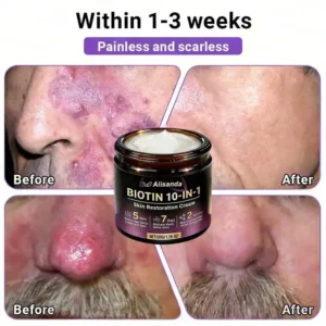 Watch Them Fall Off! ✨ Alisanda® 10-in-1 Skin Clear