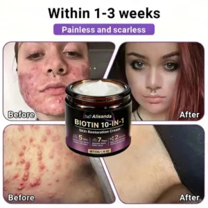 Watch Them Fall Off! ✨ Alisanda® 10-in-1 Skin Clear