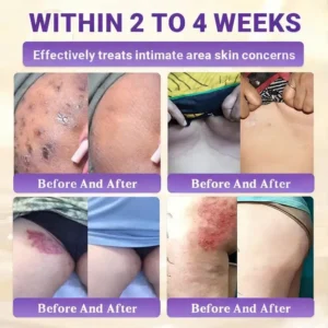 Watch Them Fall Off! ✨ Alisanda® 10-in-1 Skin Clear