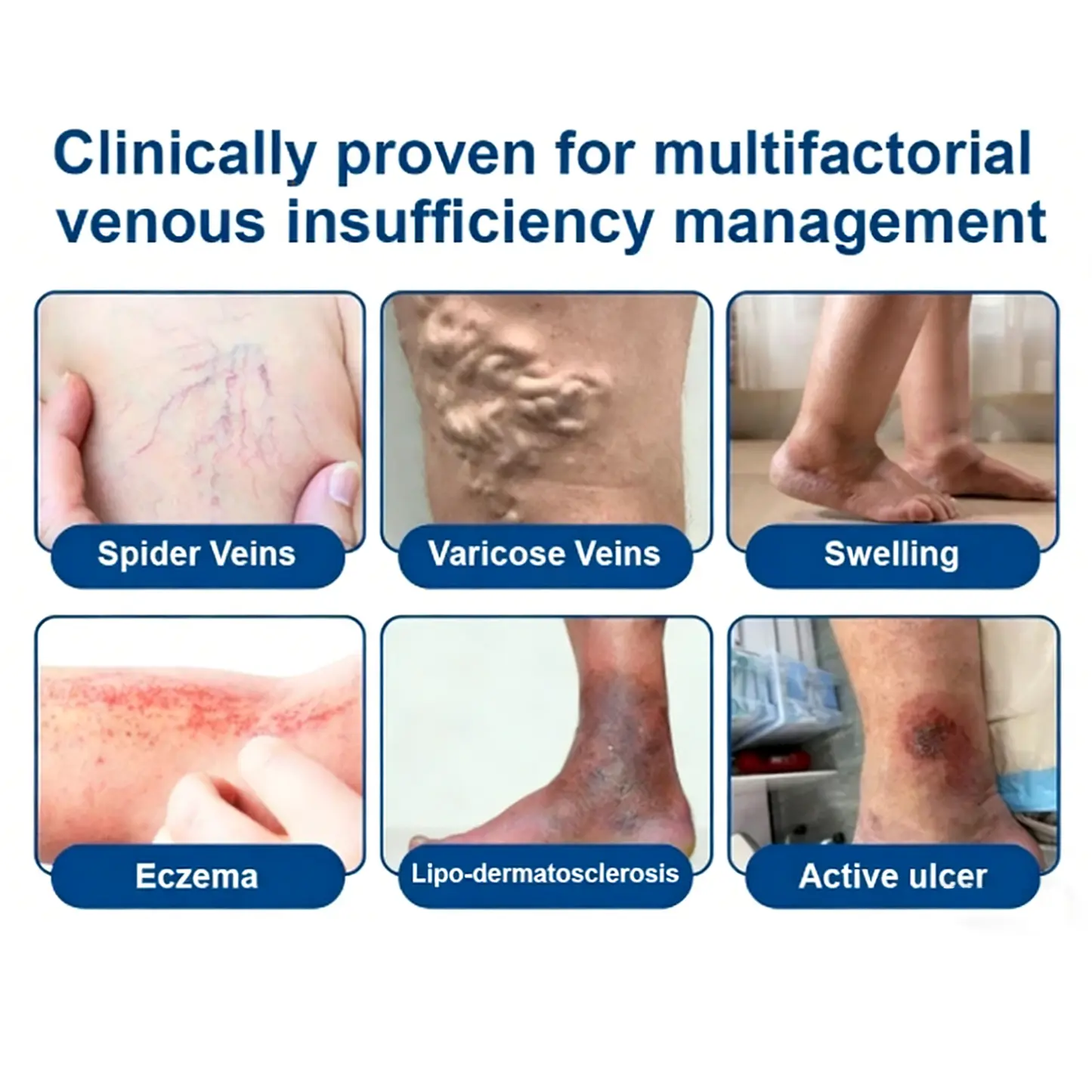Alisanda® Skip Costly Procedures — Find Relief With One Easy Patch!