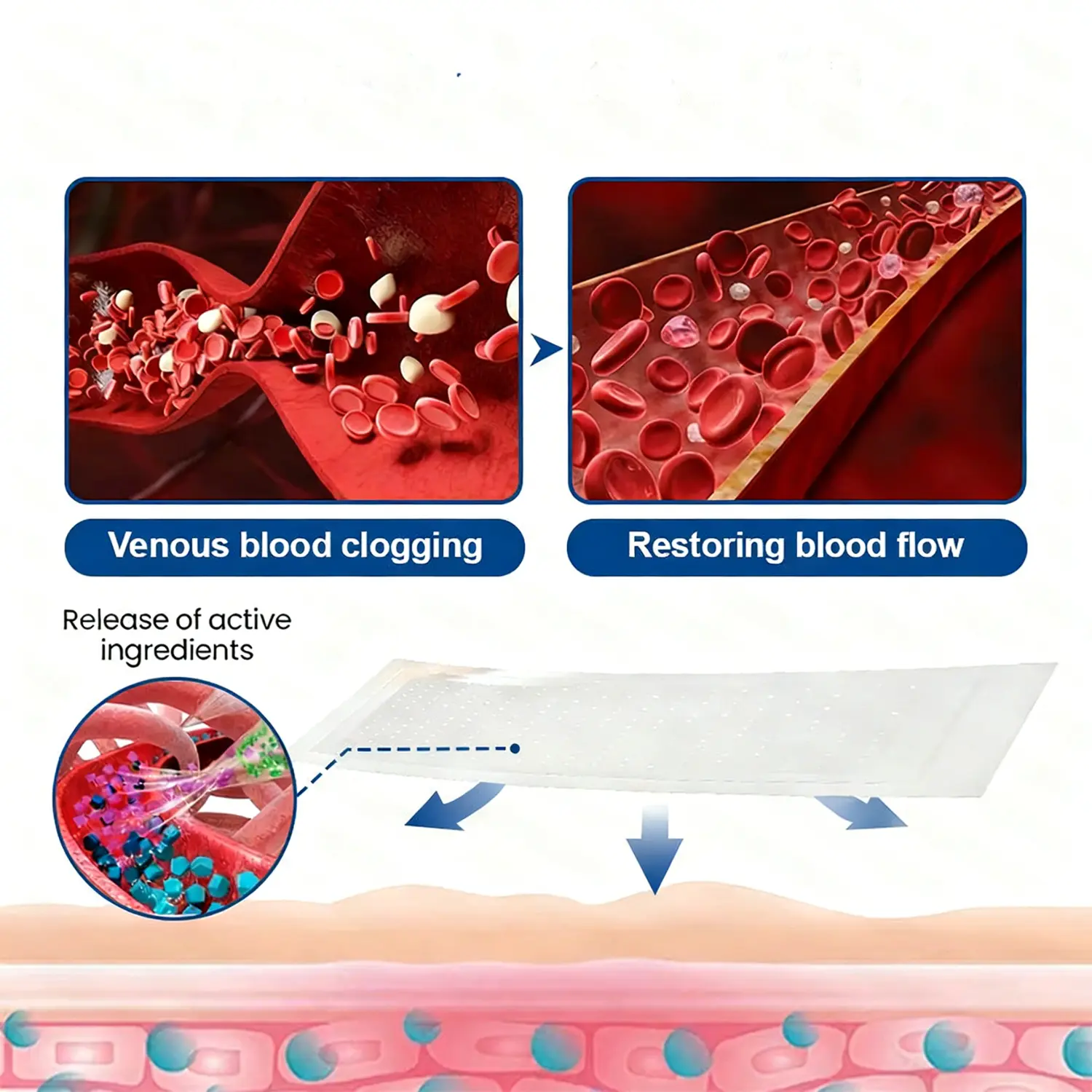 Alisanda® Vein Relief Patch|Smoother-Looking Legs