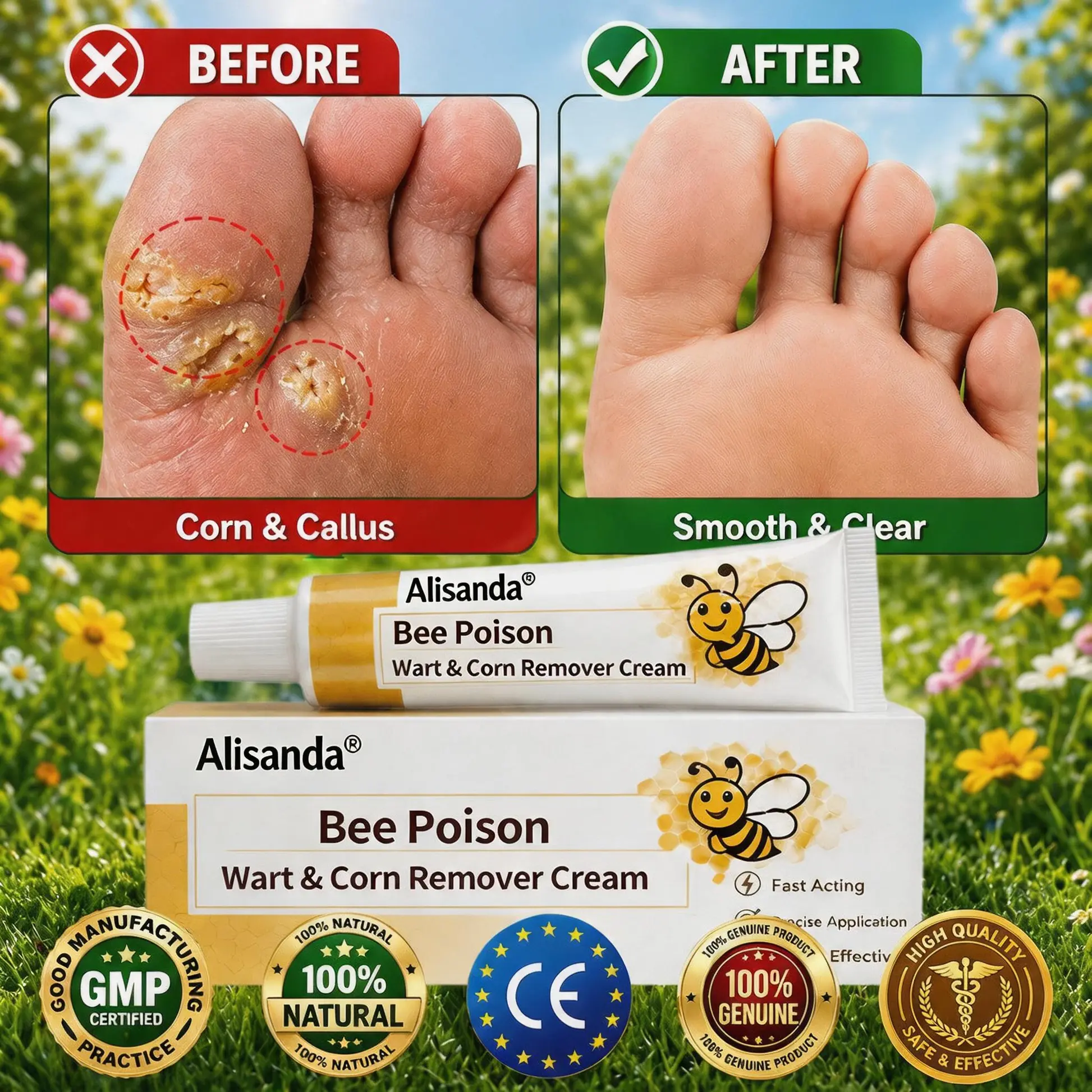 👨⚕️Alisanda®Bee Poison Wart & Corn Remover Cream⚡