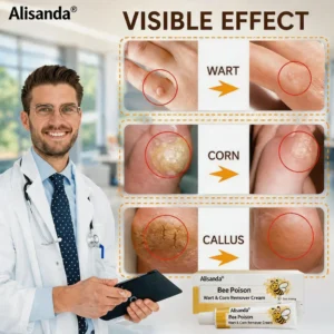 👨⚕️Alisanda®Bee Poison Wart & Corn Remover Cream⚡