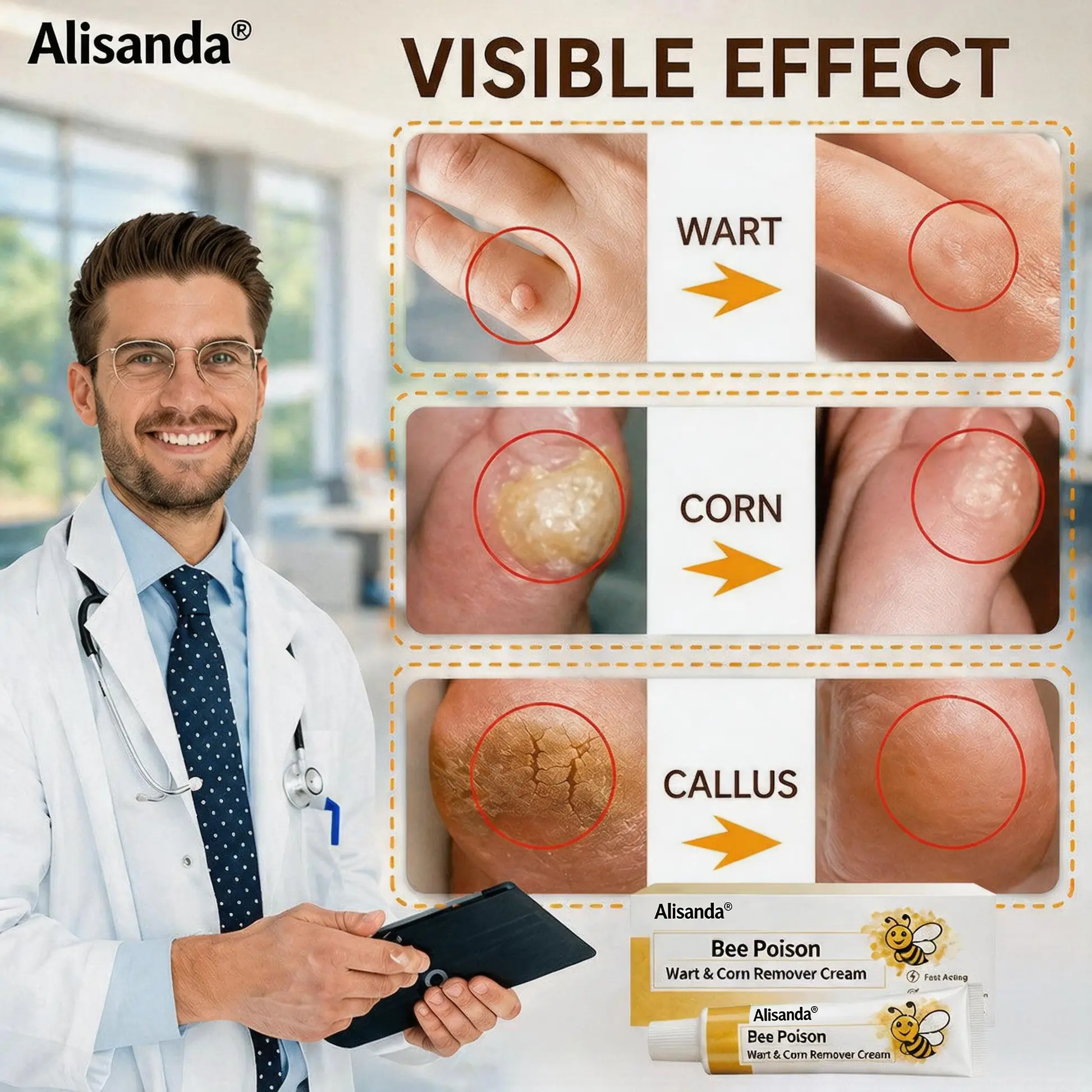 👨⚕️Alisanda®Bee Poison Wart & Corn Remover Cream⚡