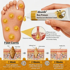 👨⚕️Alisanda®Bee Poison Wart & Corn Remover Cream⚡
