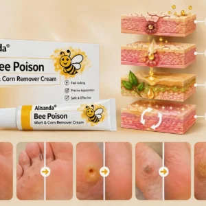 👨⚕️Alisanda®Bee Poison Wart & Corn Remover Cream⚡