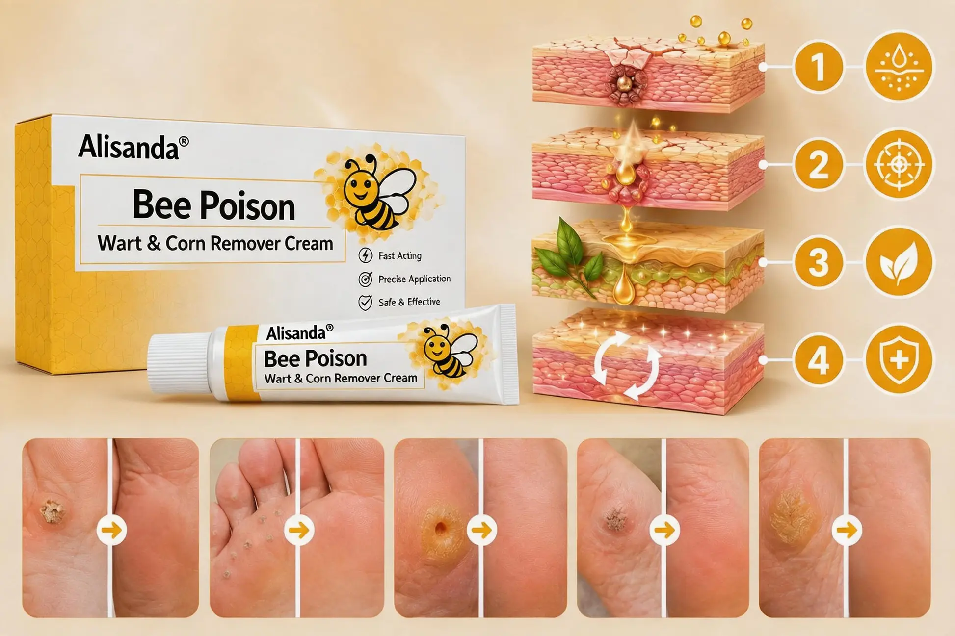 👨⚕️Alisanda®Bee Poison Wart & Corn Remover Cream⚡