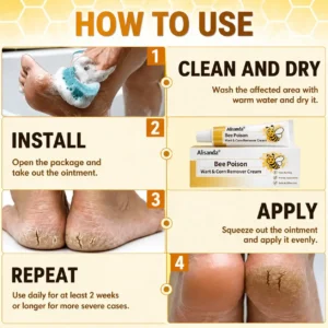 👨⚕️Alisanda®Bee Poison Wart & Corn Remover Cream⚡
