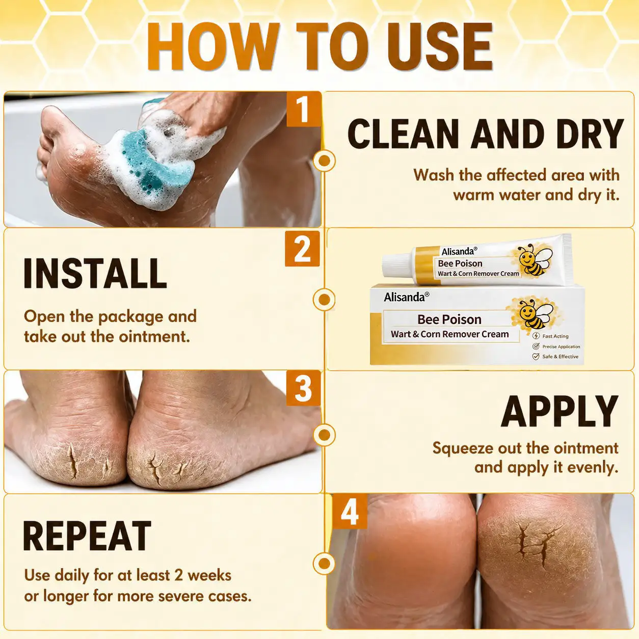 👨⚕️Alisanda®Bee Poison Wart & Corn Remover Cream⚡