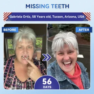 👨⚕️𝑶𝒇𝒇𝒊𝒄𝒊𝒂𝒍 𝑺𝒕𝒐𝒓𝒆 | Alisanda®🦷Tideglusib Fast‑Dissolving Tooth & Gum Repair Oral Strips ✨
