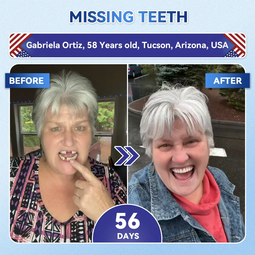 👨⚕️𝑶𝒇𝒇𝒊𝒄𝒊𝒂𝒍 𝑺𝒕𝒐𝒓𝒆 | Alisanda®🦷Tideglusib Fast‑Dissolving Tooth & Gum Repair Oral Strips ✨