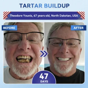 👨⚕️𝑶𝒇𝒇𝒊𝒄𝒊𝒂𝒍 𝑺𝒕𝒐𝒓𝒆 | Alisanda®🦷Tideglusib Fast‑Dissolving Tooth & Gum Repair Oral Strips ✨