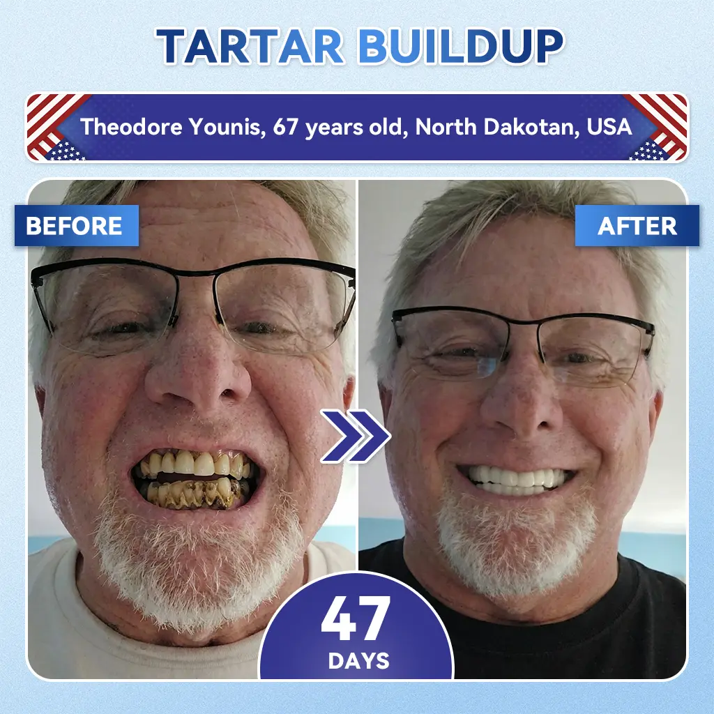 👨⚕️𝑶𝒇𝒇𝒊𝒄𝒊𝒂𝒍 𝑺𝒕𝒐𝒓𝒆 | Alisanda®🦷Tideglusib Fast‑Dissolving Tooth & Gum Repair Oral Strips ✨