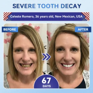 👨⚕️𝑶𝒇𝒇𝒊𝒄𝒊𝒂𝒍 𝑺𝒕𝒐𝒓𝒆 | Alisanda®🦷Tideglusib Fast‑Dissolving Tooth & Gum Repair Oral Strips ✨