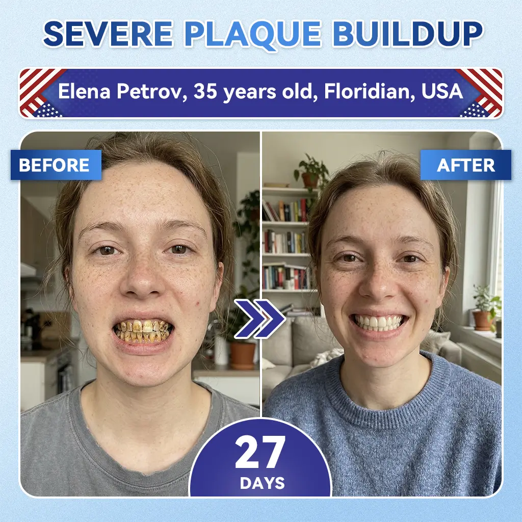 👨⚕️𝑶𝒇𝒇𝒊𝒄𝒊𝒂𝒍 𝑺𝒕𝒐𝒓𝒆 | Alisanda®🦷Tideglusib Fast‑Dissolving Tooth & Gum Repair Oral Strips ✨