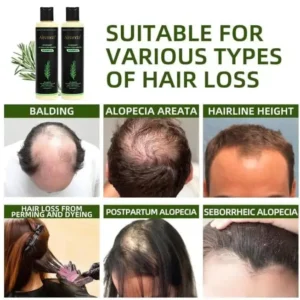 🔥LAST DAY 20% OFF - 🌿Alisanda® Organic Rosemary Hair Growth Shampoo