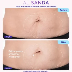 💜 ALISANDA Tighten & Smooth Belly Cream – Firming, Stretch Mark & Loose Skin Care ✨