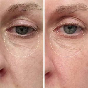 ALISANDA Golden Glow Eye Balm — Ghee + Gotu Kola