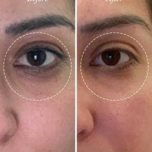 ALISANDA Golden Glow Eye Balm — Ghee + Gotu Kola