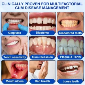 🇺🇸🏆🦷✨Alisanda® GumRevive Periodontal Repair Gel
– Savorselects
