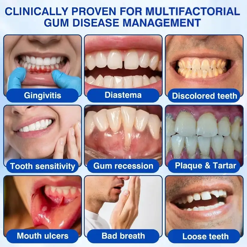 🇺🇸🏆🦷✨Alisanda® GumRevive Periodontal Repair Gel
– Savorselects