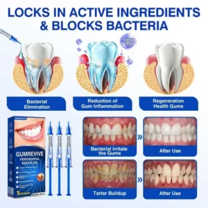🇺🇸🏆🦷✨Alisanda® GumRevive Periodontal Repair Gel
– Savorselects