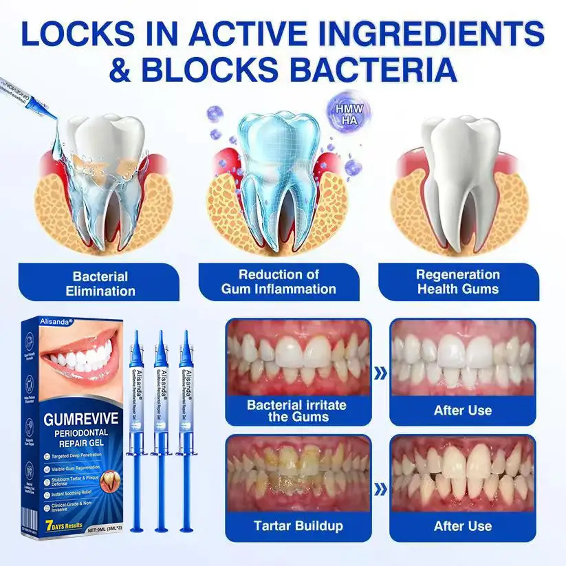 🇺🇸🏆🦷✨Alisanda® GumRevive Periodontal Repair Gel
– Savorselects
